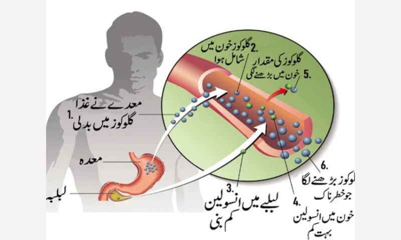 ذیابیطس سے چھٹکارا دلا نے والا علاج دریافت