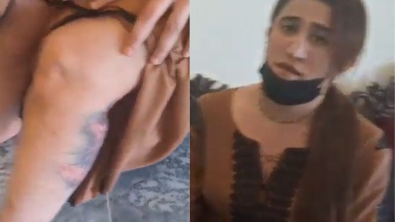 ٹرانس جینڈر خاتون پر مبینہ تشدد، شدید ردعمل