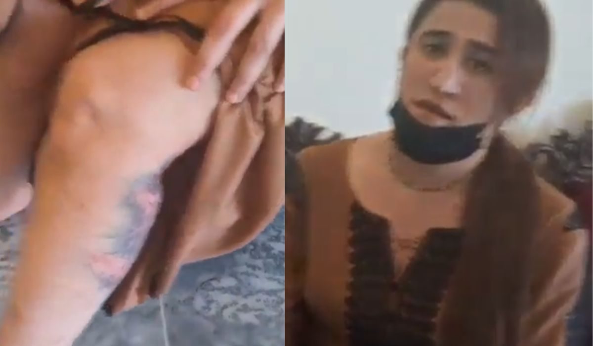 ٹرانس جینڈر خاتون پر مبینہ تشدد، شدید ردعمل