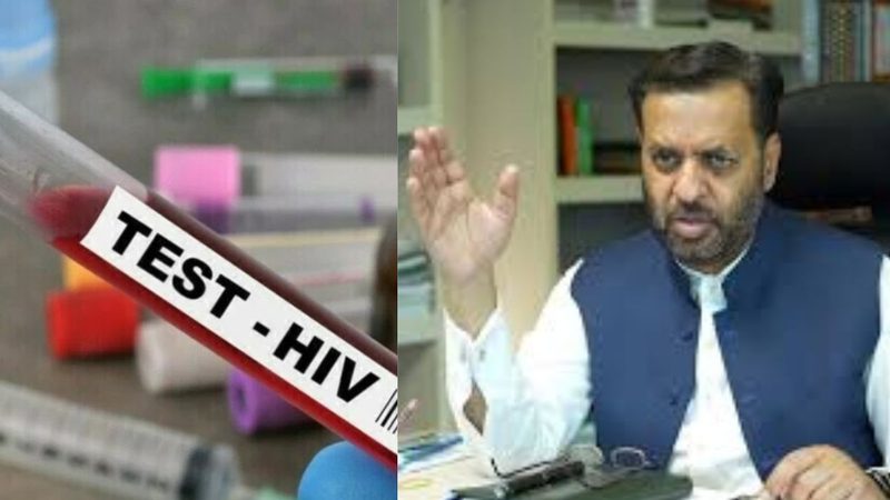 HIV اسکریننگ آپریشن سے قبل لازمی قرار